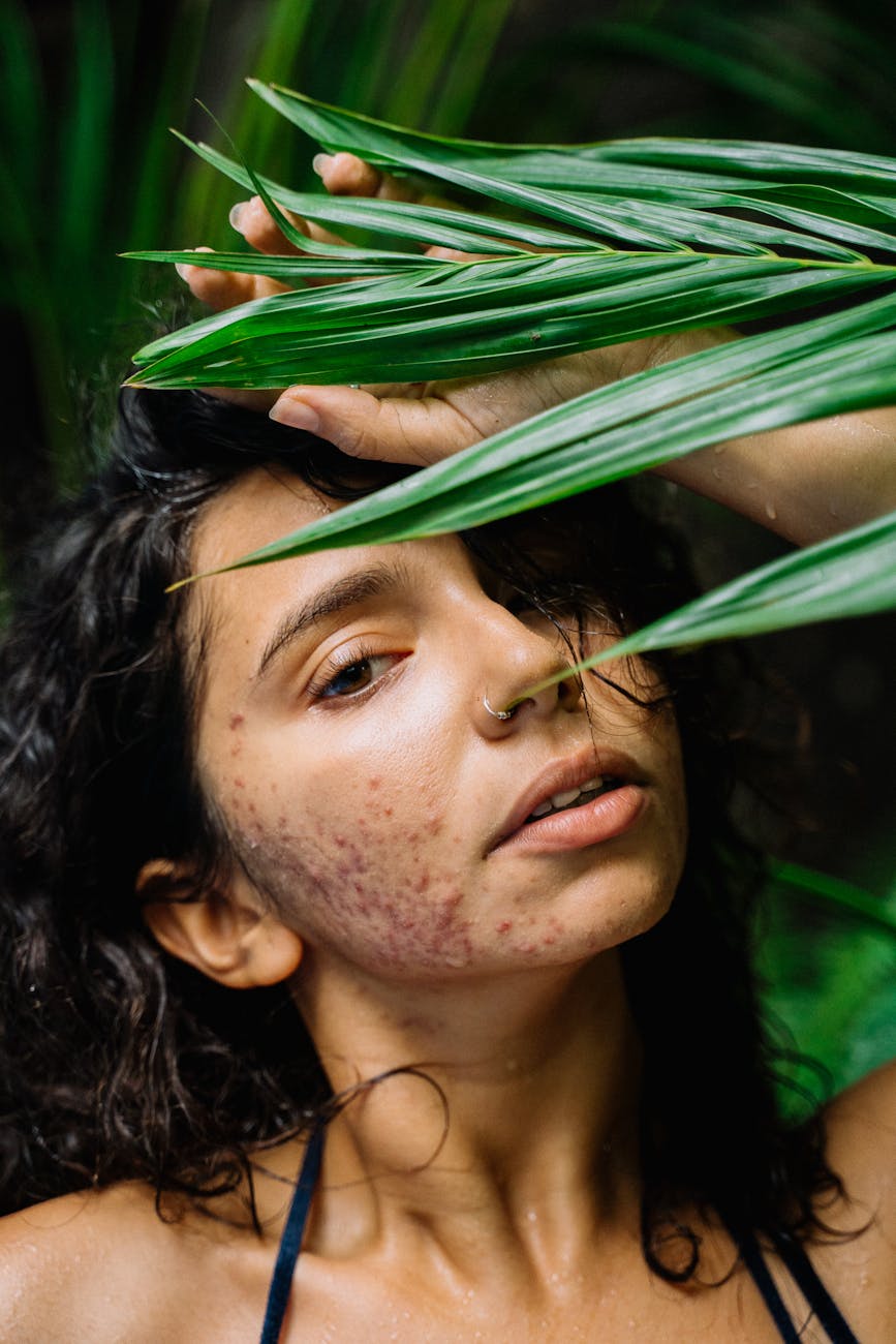 curly hair woman with acne and nose piercing
